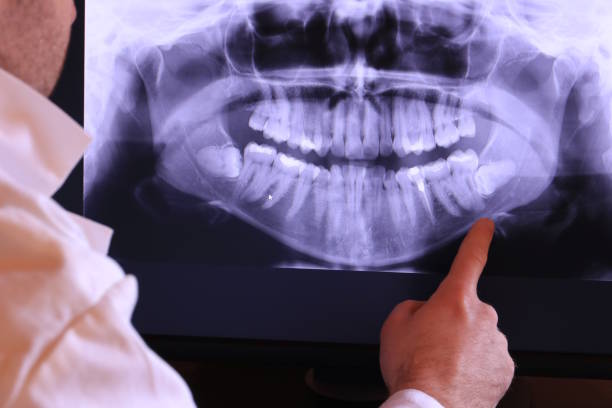 Best Walk-In Emergency Dentist in Reserve, LA